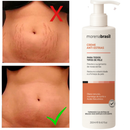Creme AntiEstrias Removedor Estrias 200g Morena Brasil – Ação Poderosa com Colágeno e Elastina