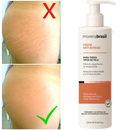 Creme AntiEstrias Removedor Estrias 200g Morena Brasil – Ação Poderosa com Colágeno e Elastina