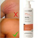 Creme AntiEstrias Removedor Estrias 200g Morena Brasil – Ação Poderosa com Colágeno e Elastina