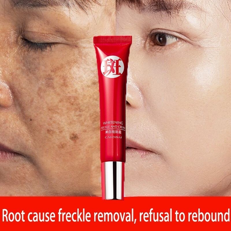 Creme forte original para remover manchas escuras/clareamento pigmentado/cuidados com a pele